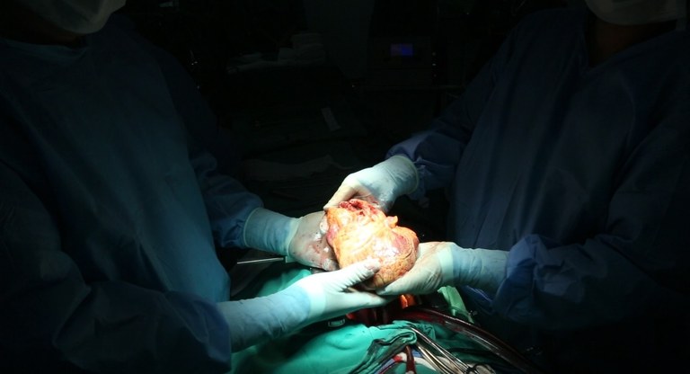 transplante de coração hospital metropolitano_1.jpg