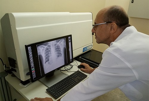 Novo equipamento otimiza diagnóstico por imagem no Clementino Fraga